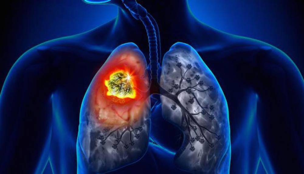 Portland, Oregon a TOXIC AIR MESS